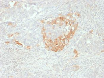 Anti-NSE gamma (Neuron Specific Enolase, gamma) (Neuroendocrine Marker) Monoclonal Antibody(Clone: NSE-P2)