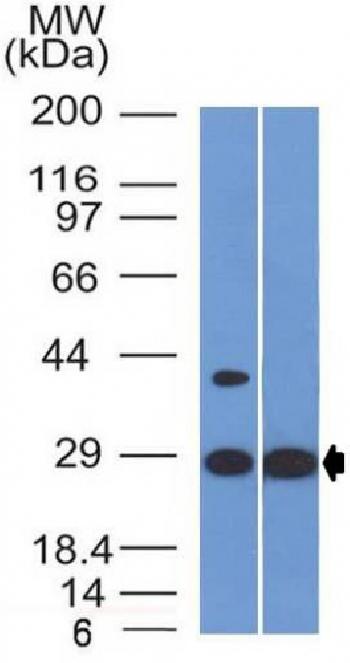 Anti-Erythropoietin (EPO) (Marker of Placentation Disorders) Monoclonal Antibody(Clone: EPO/1368)