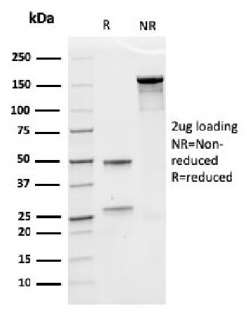 Anti-Erythropoietin (EPO) (Marker of Placentation Disorders) Monoclonal Antibody(Clone: rEPO/1367)