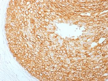 Anti-HER-2 / c-erbB-2 / neu / CD340 Monoclonal Antibody(Clone: ERBB2/2453)