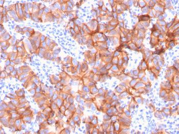 Anti-HER-2 / c-erbB-2 / neu / CD340 Monoclonal Antibody(Clone: ERBB2/3079)