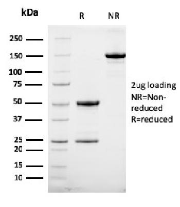 Anti-HER-2 / c-erbB-2 / neu / CD340 Monoclonal Antibody(Clone: HRB2/258)