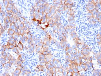 Anti-HER-2 / c-erbB-2 / neu / CD340 Monoclonal Antibody(Clone: ERBB2/3080)