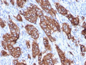 Anti-HER-2 / c-erbB-2 / neu / CD340 Monoclonal Antibody(Clone: ERBB2/3093)