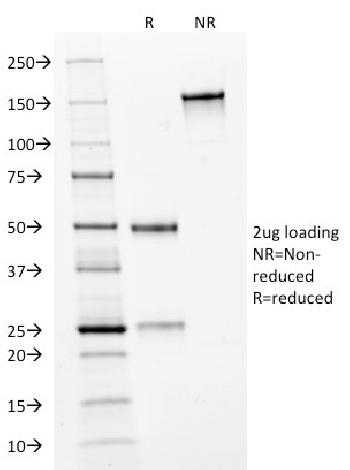 Anti-HER-2 / c-erbB-2 / neu / CD340 Monoclonal Antibody(Clone: HRB2/282)