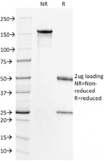 Anti-HER-2 / c-erbB-2 / neu / CD340 Monoclonal Antibody(Clone: HRB2/718)