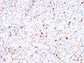 Anti-ERCC1 / RAD10 (Tumor Progression Marker) Monoclonal Antibody(Clone: ERCC1/2318)