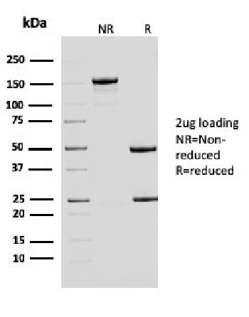 Anti-ERCC1 / RAD10 (Tumor Progression Marker) Monoclonal Antibody(Clone: ERCC1/2683)