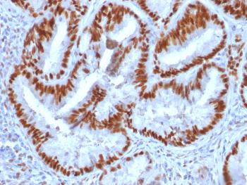 Anti-Estrogen Receptor, alpha (Marker of Estrogen Dependence) Monoclonal Antibody(Clone: 1D5)