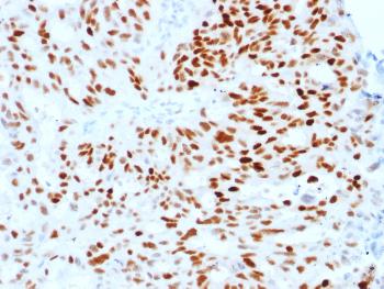 Anti-Estrogen Receptor, alpha (Marker of Estrogen Dependence) Monoclonal Antibody(Clone: ESR1/1904)