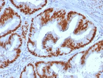 Anti-Estrogen Receptor, alpha (Marker of Estrogen Dependence) Monoclonal Antibody(Clone: ESR1/1935)