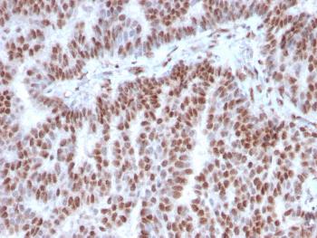 Anti-Estrogen Receptor, alpha (Marker of Estrogen Dependence) Monoclonal Antibody(Clone: ESR1/3342)