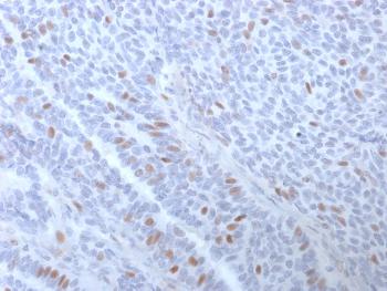 Anti-Estrogen Receptor, alpha (Marker of Estrogen Dependence) Monoclonal Antibody(Clone: ESR1/3373)