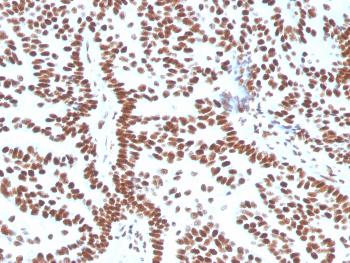 Anti-Estrogen Receptor, alpha (Marker of Estrogen Dependence) Monoclonal Antibody(Clone: ESR1/3556)