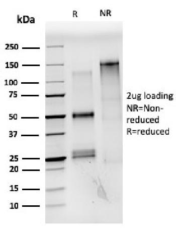 Anti-Estrogen Receptor, alpha (Marker of Estrogen Dependence) Monoclonal Antibody(Clone: ESR1/3559)