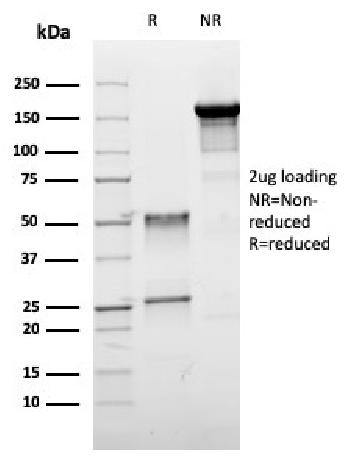 Anti-ER-beta-1 (Estrogen Receptor beta-1) Monoclonal Antibody(Clone: ESR2/3005)