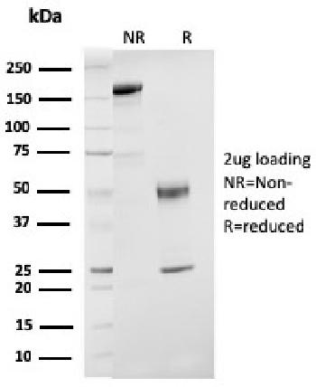 Anti-ER-beta-1 (Estrogen Receptor beta-1) Monoclonal Antibody(Clone: ESR2/3207)