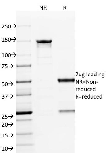 Anti-ETS1 (Marker of Tumor Metastasis) Monoclonal Antibody(Clone: ETS1/1801)