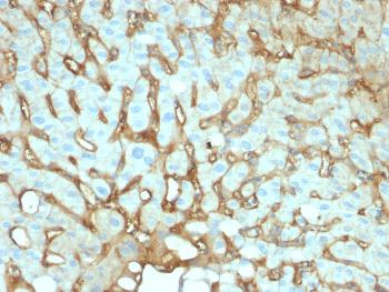 Anti-Albumin (Transport Protein) Monoclonal Antibody(Clone: ALB/2141)