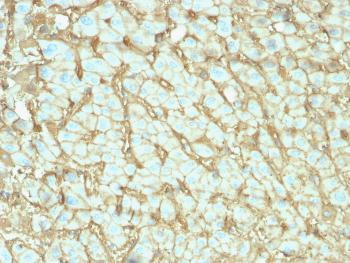 Anti-Albumin (Transport Protein) Monoclonal Antibody(Clone: ALB/2142)