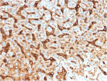 Anti-Albumin (Transport Protein) Monoclonal Antibody(Clone: ALB/2144)