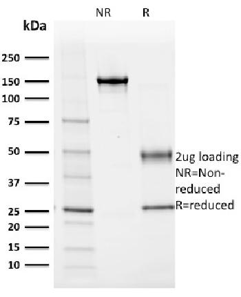 Anti-Albumin (Transport Protein) Monoclonal Antibody(Clone: ALB/2355)