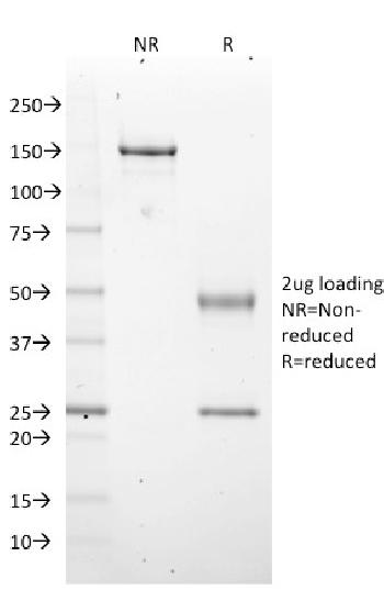 Anti-EZH2 / KMT6 Monoclonal Antibody(Clone: EZH2/2536)