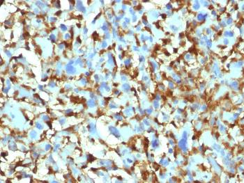 Anti-Factor XIIIa (Coagulation Factor XIIIA Chain) Monoclonal Antibody(Clone: F13A1/1448)