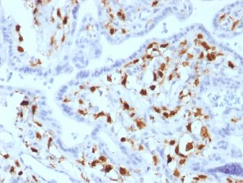 Anti-Factor XIIIa (Coagulation Factor XIIIA Chain) Monoclonal Antibody(Clone: SPM180)