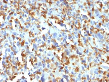 Anti-Factor XIIIa (Coagulation Factor XIIIA Chain) Monoclonal Antibody(Clone: F13A1/1683)