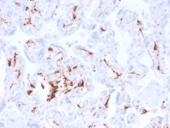 Anti-Factor XIIIa (Coagulation Factor XIIIA Chain) Monoclonal Antibody(Clone: F13A1/3772R)