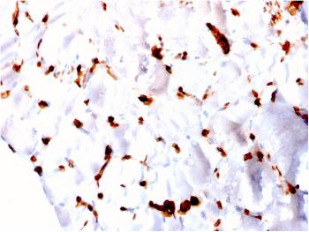 Anti-FABP5 (Marker of Metastatic Potential in Colorectal Cancer) Monoclonal Antibody(Clone: CPTC-FABP5-3)