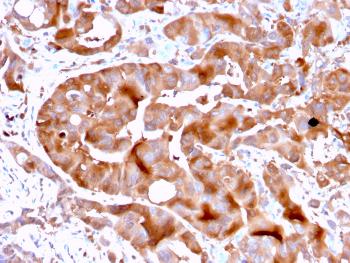 Anti-FABP5 (Marker of Metastatic Potential in Colorectal Cancer) Monoclonal Antibody(Clone: FABP5/3750)