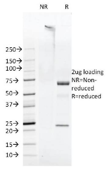 Anti-FAT1 (FAT atypical cadherin 1) Monoclonal Antibody(Clone: FAT1-3D7/1)