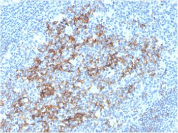 Anti-CD23 (Fc Epsilon RII) Monoclonal Antibody(Clone: FCER2/3592)