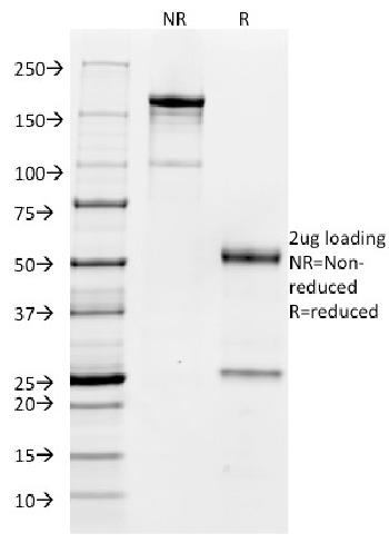 Anti-CD32 (Fc Gamma RIIa) Monoclonal Antibody(Clone: FCGR2A/479)