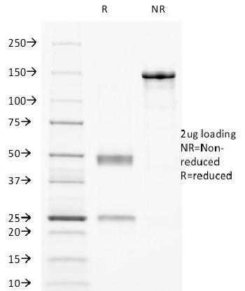 Anti-CD32 (Fc Gamma RIIa) Monoclonal Antibody(Clone: 8.7)