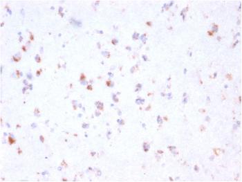 Anti-FCGRT / FcRn (IgG Transporter) Monoclonal Antibody(Clone: FCGRT/2932)