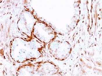 Anti-Aldo-keto Reductase Family 1 Member B1 (Adrenal Marker) Monoclonal Antibody(Clone: CPTC-AKR1B1-3)