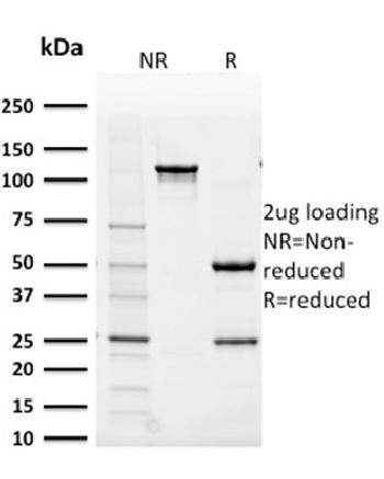 Anti-Aldo-keto Reductase Family 1 Member B1 (Adrenal Marker) Monoclonal Antibody(Clone: CPTC-AKR1B1-2)