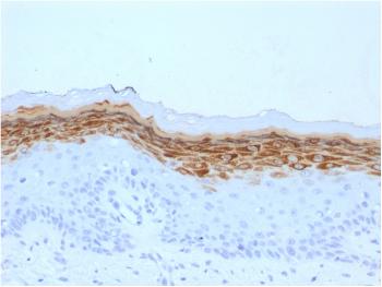 Anti-Filaggrin (Keratinocyte Differentiation Marker) Monoclonal Antibody(Clone: FLG/1561)