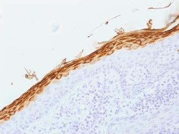 Anti-Filaggrin (Keratinocyte Differentiation Marker) Monoclonal Antibody(Clone: FLG/1562)