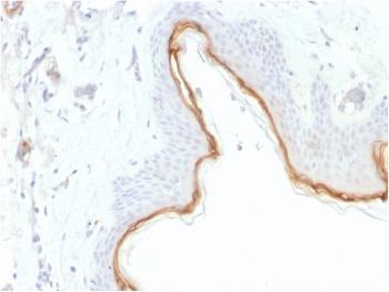 Anti-Filaggrin (Keratinocyte Differentiation Marker) Monoclonal Antibody(Clone: FLG/1945)