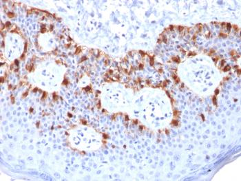 Anti-MART-1 / Melan-A / MLANA (Melanoma Marker) Monoclonal Antibody(Clone: rMLANA/788)