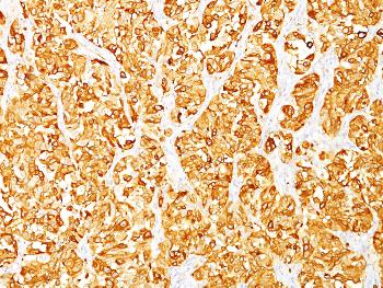 Anti-MART-1 / Melan-A / MLANA (Melanoma Marker) Monoclonal Antibody(Clone: DT101 + BC199)