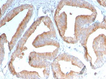 Anti-ICOS-L / ICOS Ligand / B7RP-1 (Immuno-Oncology Target) Monoclonal Antibody(Clone: ICOSL/3111)