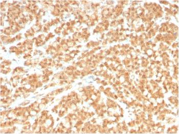 Anti-ICOS-L / ICOS Ligand / B7RP-1 (Immuno-Oncology Target) Monoclonal Antibody(Clone: ICOSL/3260)