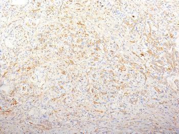 Anti-Fibronectin (Cellular & Plasma) Monoclonal Antibody(Clone: TV-1)