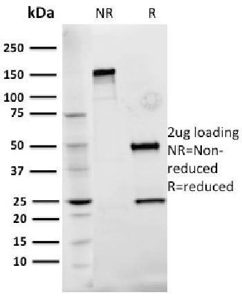 Anti-Fibronectin Monoclonal Antibody(Clone: Fn-3)