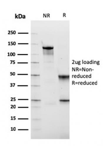 Anti-Fibronectin Monoclonal Antibody(Clone: FN1/2949)